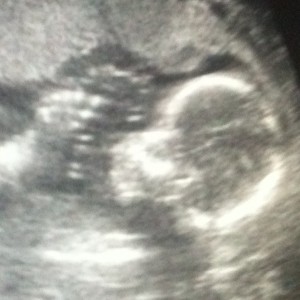 zwanger - echo - baby - Peer Voedingadvies